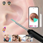 Load image into Gallery viewer, 無線高清挖耳內視鏡