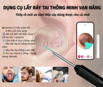 Load image into Gallery viewer, Dụng Cụ Lấy Ráy Tai Có Camera không dây, kết nối với ứng dụng thông minh (APP)