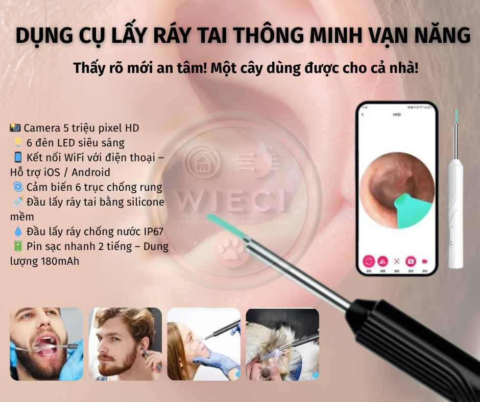 Dụng Cụ Lấy Ráy Tai Có Camera không dây, kết nối với ứng dụng thông minh (APP)